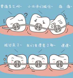 东莞箍牙